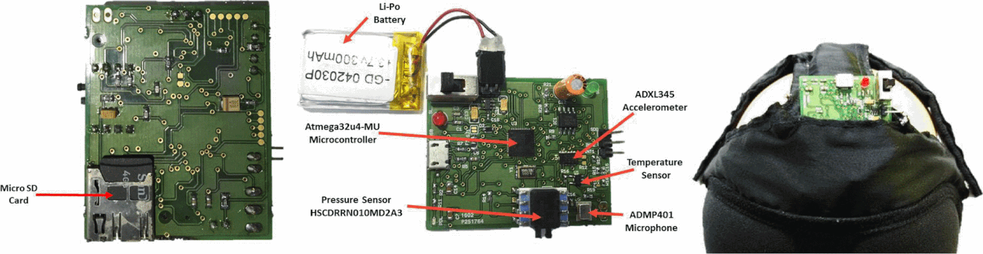 At-Home Sleep Apnea Screening