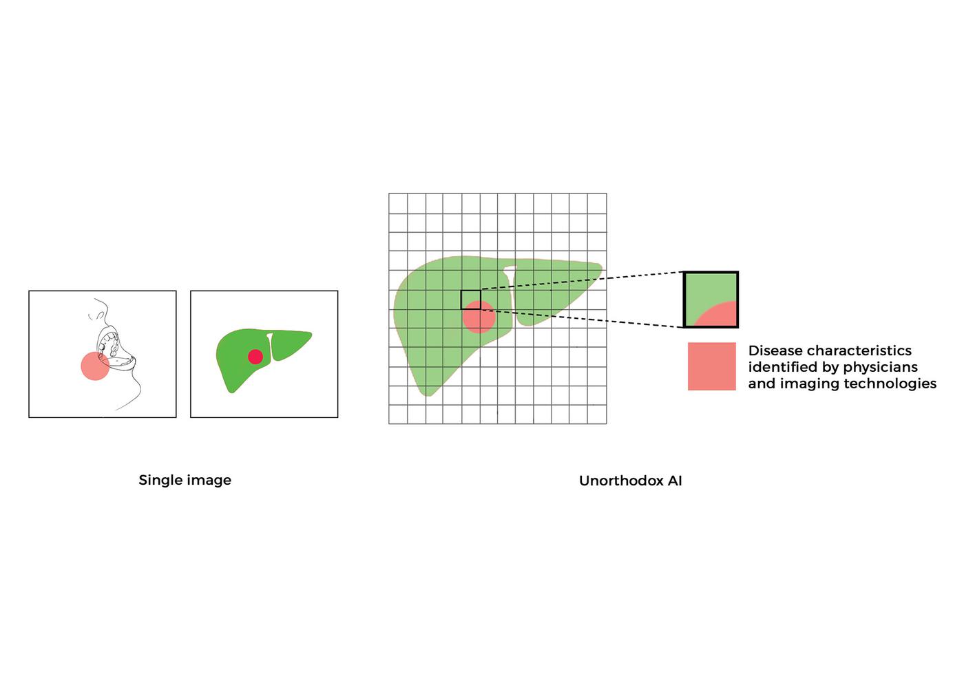 Generative Deep Learning for Medical Images