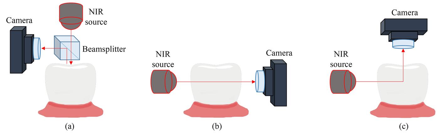 Near-Infrared-Transillumination-for-Dental-3D- Radiography-and-Cone-Beam-Computed- Tomography-Imaging